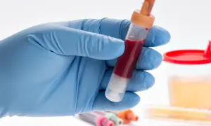 Ręka w niebieskiej rękawiczce trzyma probówkę z krwią. W tle pojemnik z żółtym płynem i inne probówki. To nie jest obrazek, gdzie pies sika krwią.